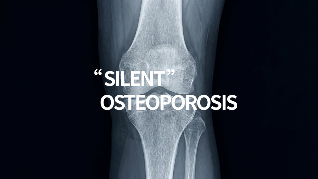 Can Osteoporosis Be Reversed? – A Complete Bone Health Guide From Mulittea supplement